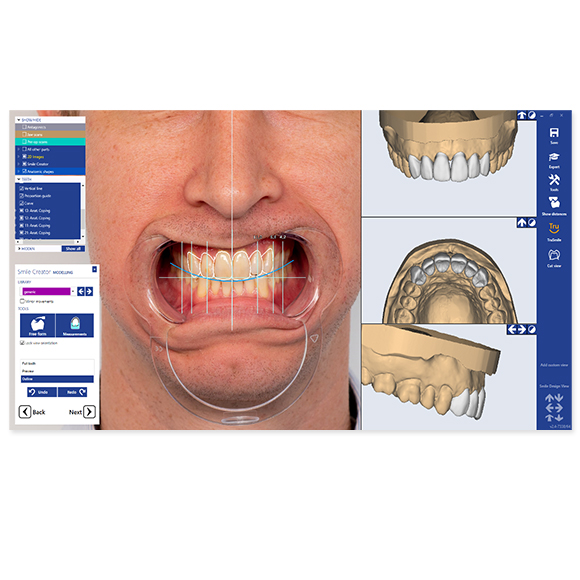 Planmeca PlanCAD Premium Design Software